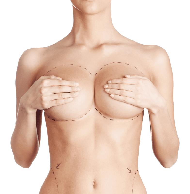 chirurgie esthétique en Tunisie - chirurgie mammaire