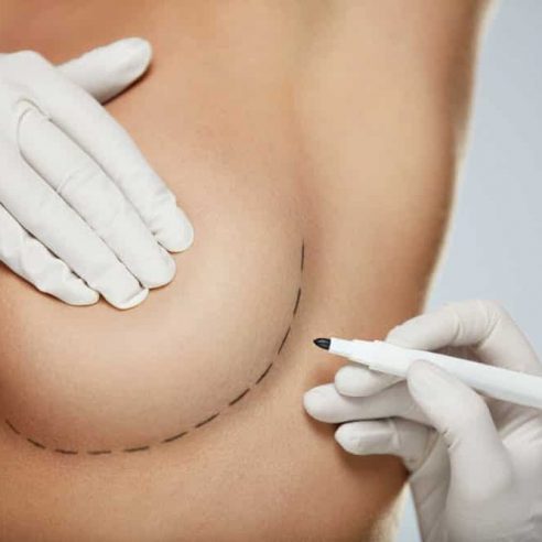 Chirurgie mammaire en tunisie - Medcare Vacances