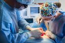 bdominoplastie