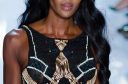 Naomi Campbell chirurgie esthétique